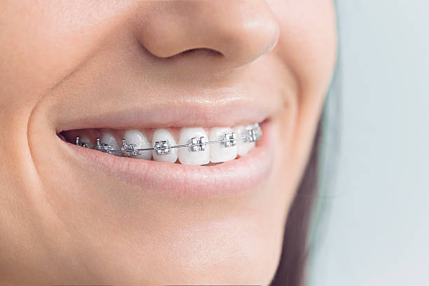 Best Veneers and Lumineers  in Willacoochee, GA